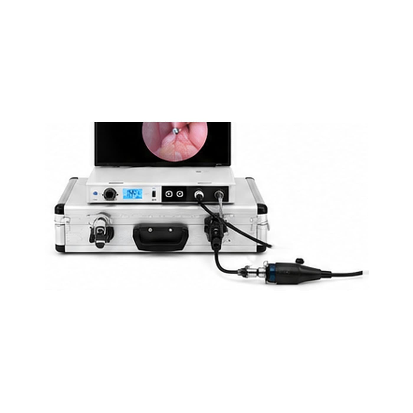 All In One Portable Endoscopic System